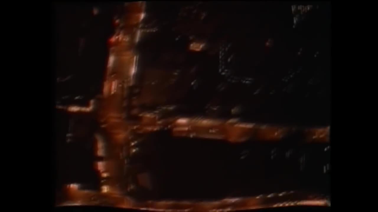 Phil Collins - Both Sides of the Story